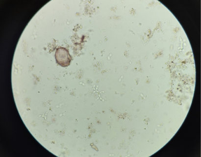 levures sous le microscope